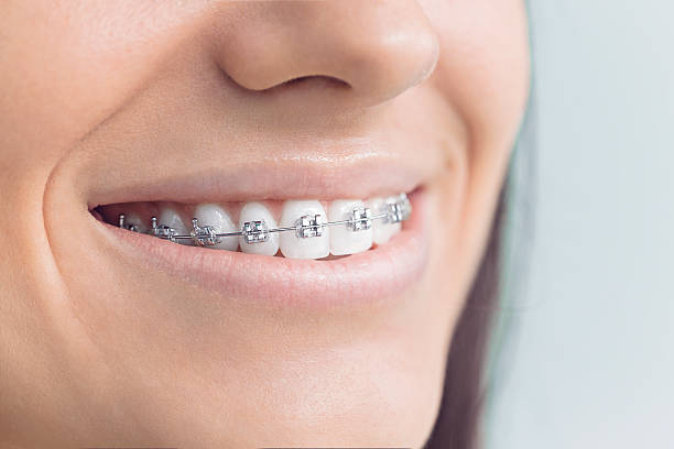 Best Veneers and Lumineers  in Crystal Lakes, OH